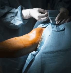  Arthroscopy hospital in chinchwad