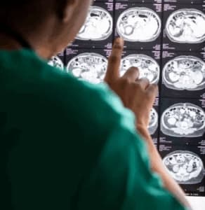 Neurosurgery hospital in chinchwad